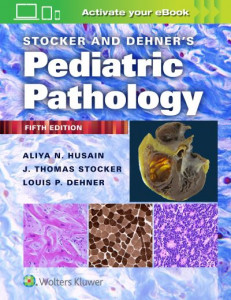 Stocker and Dehner's Pediatric Pathology by Aliya N. Husain (Hardback)