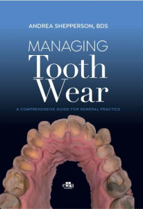 Managing Tooth Wear by Andrea Shepperson (Hardback)