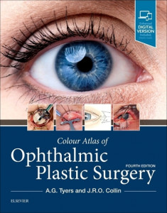 Colour Atlas of Ophthalmic Plastic Surgery by A. G. Tyers (Hardback)