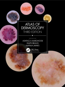 Atlas of Dermoscopy: Third Edition by Ashfaq A Marghoob (Memorial Sloan Kettering Cancer Center, 800 Veterans Memorial Highway, Hauppauge, NY 11766, USA) (Hardback)