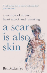 A Scar Is Also Skin by Ben Mckelvey