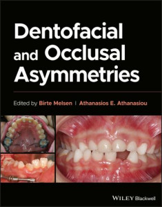 Dentofacial and Occlusal Asymmetries by Birte Melsen (Hardback)
