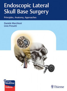 Endoscopic Lateral Skull Base Surgery by Daniele Marchioni (Hardback)