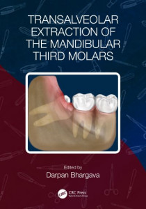 Transalveolar Extraction of the Mandibular Third Molars by Darpan Bhargava