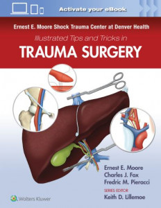 Ernest E. Moore Shock Trauma Center at Denver Health Illustrated Tips and Tricks in Trauma Surgery by Ernest Eugene Moore