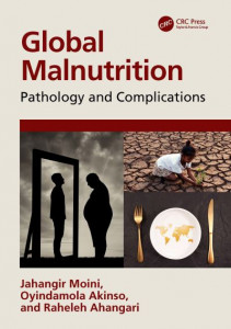 Global Malnutrition by Jahangir Moini (Hardback)
