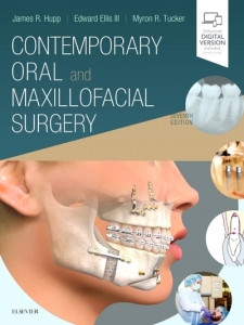Contemporary Oral and Maxillofacial Surgery by James R. Hupp (Hardback)