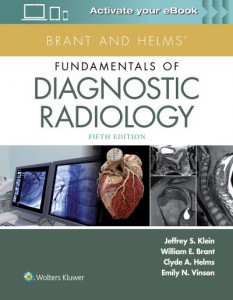 Brant and Helms' Fundamentals of Diagnostic Radiology by Jeffrey S. Klein (Hardback)