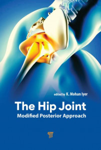 The Hip Joint by K. Mohan Iyer (Hardback)