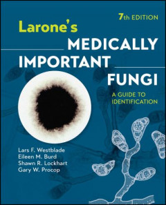 Larone's Medically Important Fungi by Lars F. Westblade (Hardback)