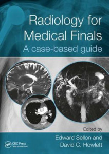 Radiology for Medical Finals: A case-based guide by Lt Col Edward Sellon