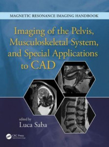 Imaging of the Pelvis, Musculoskeletal System, and Special Applications to CAD by Luca Saba (Hardback)
