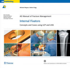 AO Manual of Fracture Management: Internal Fixators by Michael Wagner (Hardback)