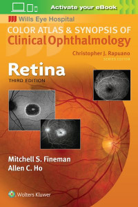 Retina by Mitchell S. Fineman