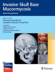 Invasive Skull Base Mucormycosis by Narayanan Janakiram (Hardback)