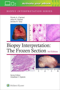 Biopsy Interpretation by Nicole A. Cipriani (Hardback)