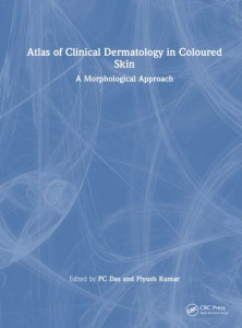 Atlas of Clinical Dermatology in Coloured Skin by P. C. Das (Hardback)