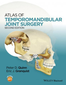 Atlas of Temporomandibular Joint Surgery by Peter D. Quinn (Hardback)