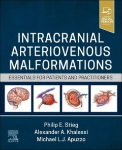 Intracranial Arteriovenous Malformations by Philip E. Stieg (Hardback)