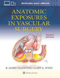 Anatomic Exposures in Vascular Surgery by R. James Valentine (Hardback)