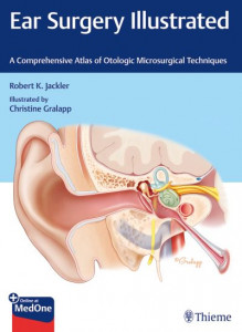 Ear Surgery Illustrated by Robert K. Jackler (Hardback)