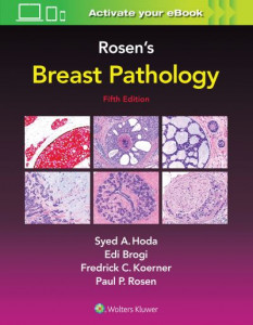 Rosen's Breast Pathology by Syed A. Hoda (Hardback)
