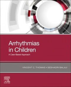 Arrhythmias in Children by Vincent C. Thomas