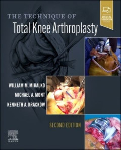 The Technique of Total Knee Arthroplasty by William M. Mihalko (Hardback)